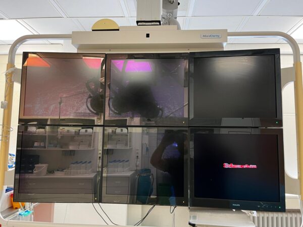 Philips Allura Clarity (Biplanares System) Angiographie-System / Philips Allura Clarity (Biplane) Angiography System