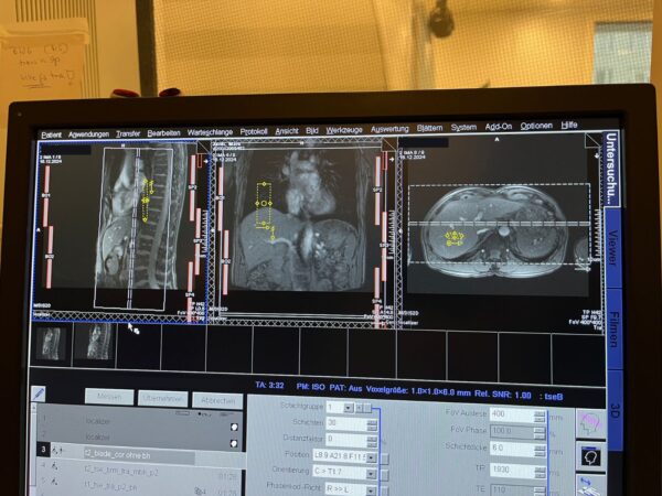Siemens - MAGNETOM Avanto - MRI Scanner - MRT Scanner