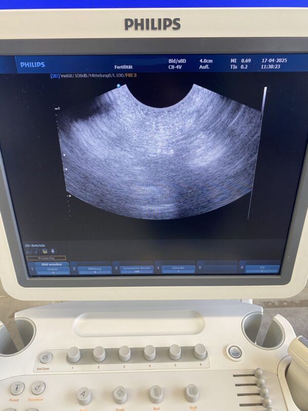 Philips - HD9 - Ultrasound System - Ultraschallgerät - REF 989605375631