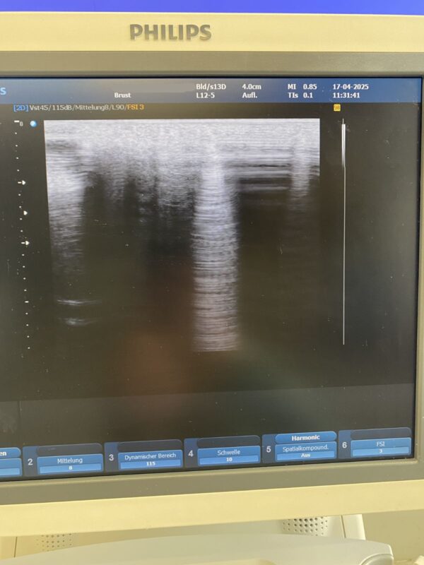 Philips - HD9 - Ultrasound System - Ultraschallgerät - REF 989605375631