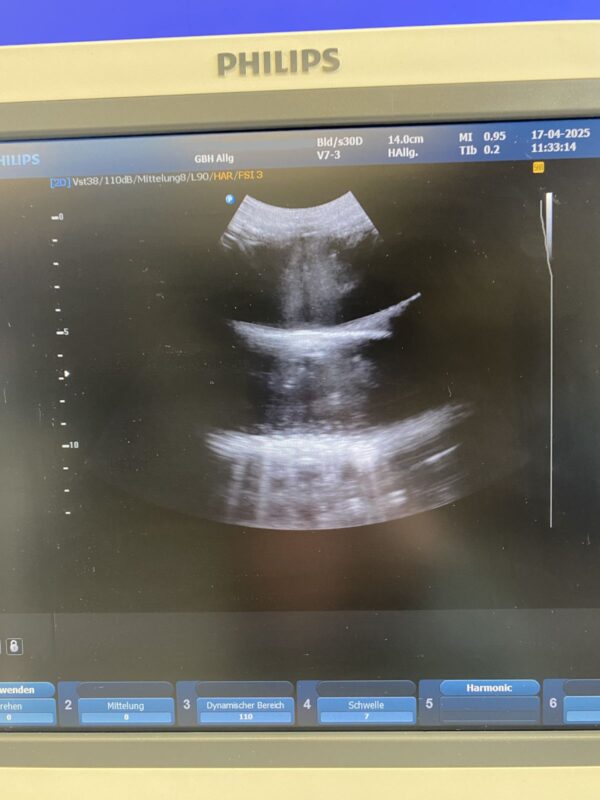 Philips - HD9 - Ultrasound System - Ultraschallgerät - REF 989605375631