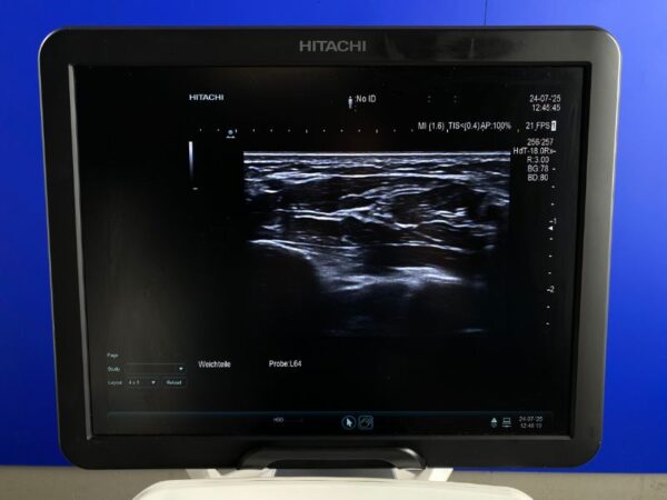 Aloka - Ultraschallgerät - Ultrasound System - ARIETTA  V70