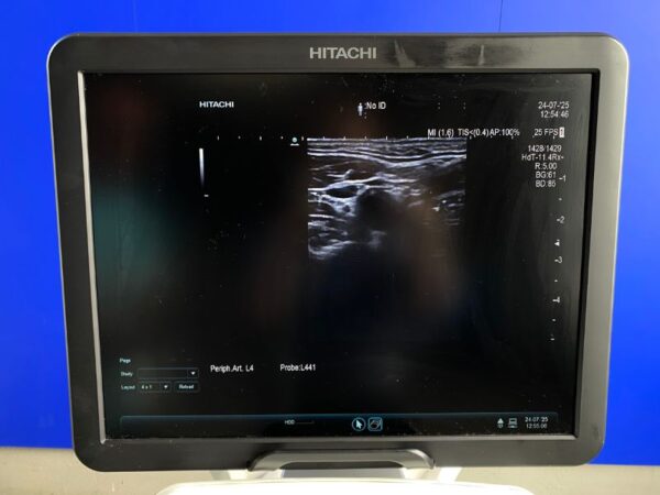 Aloka - Ultraschallgerät - Ultrasound System - ARIETTA  V70