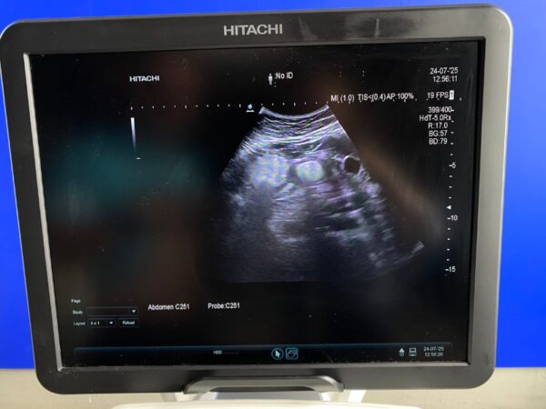Aloka - Ultraschallgerät - Ultrasound System - ARIETTA  V70