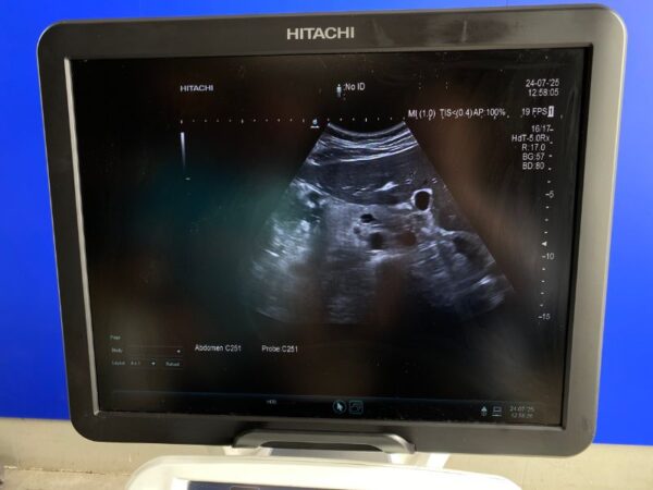 Aloka - Ultraschallgerät - Ultrasound System - ARIETTA  V70