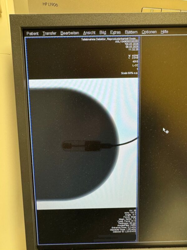 Siemens - MAMMOMAT Inspiration - Mammography System - Mammographie-System - REF 10140000
