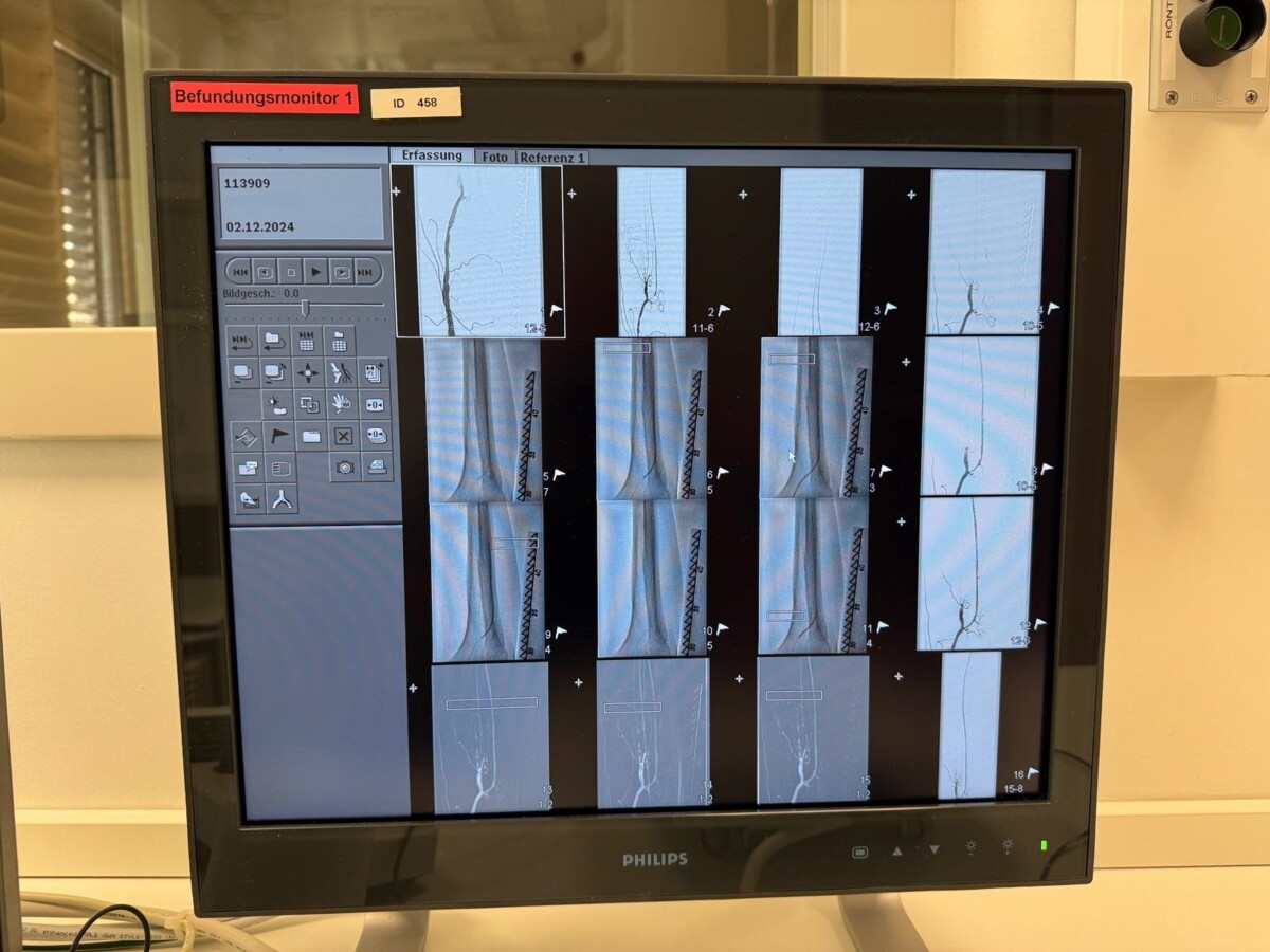 Philips - Angiography System - Angiographie-System - Allura Clarity (Monoplane Ceiling)