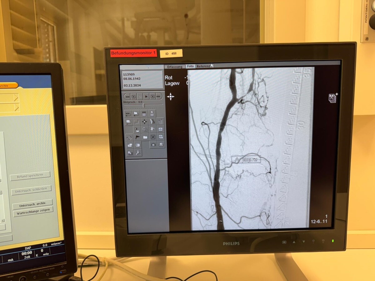 Philips - Angiography System - Angiographie-System - Allura Clarity (Monoplane Ceiling)