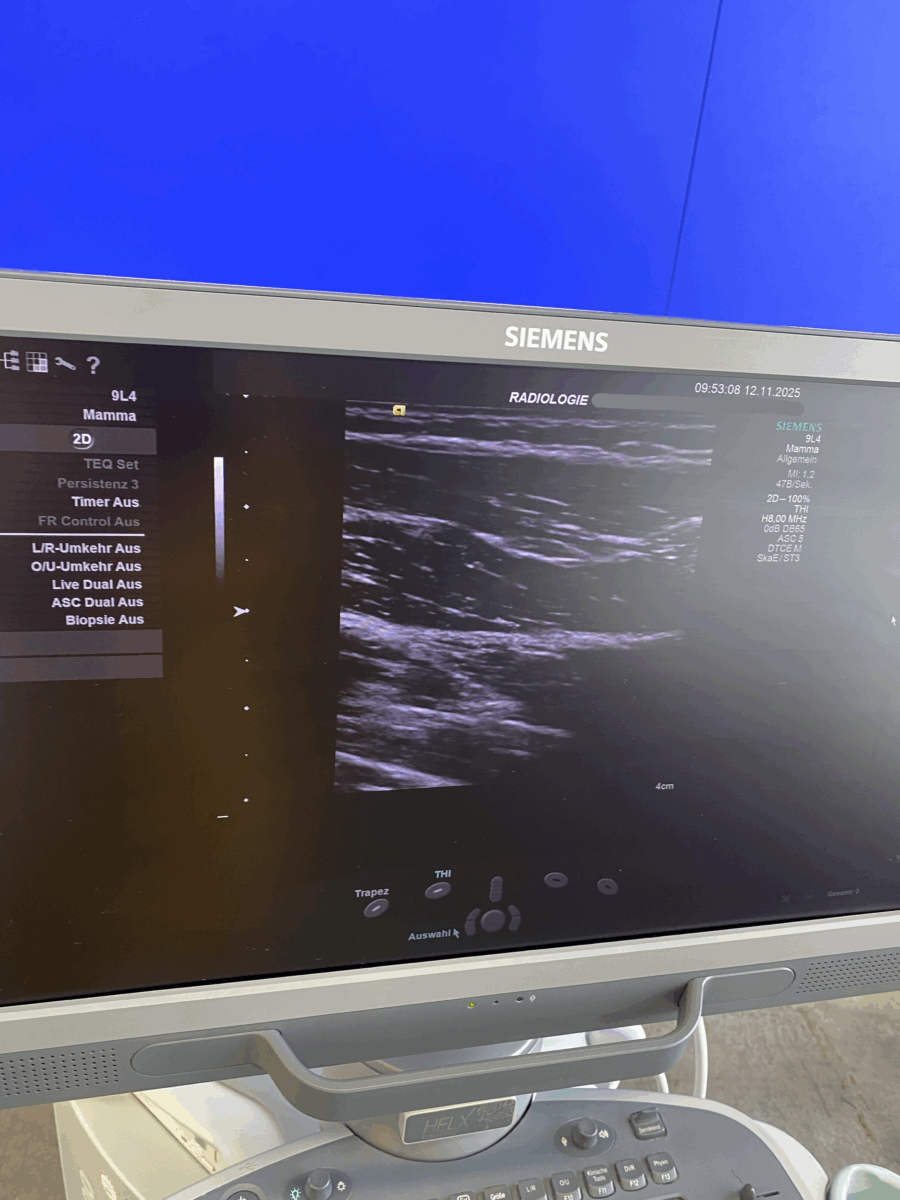 Siemens - Ultrasound System - Ultraschallgerät - ACUSON S1000 - REF 10441701