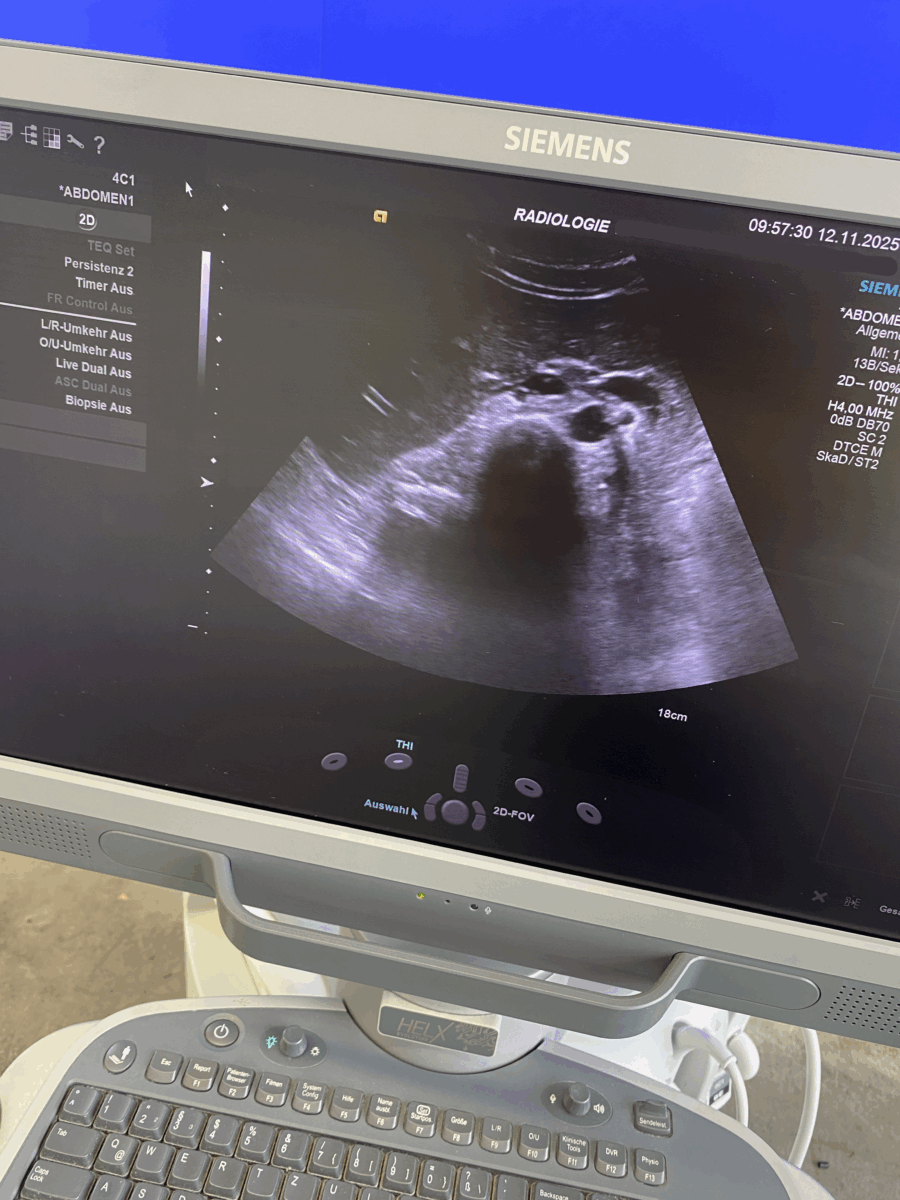 Siemens - Ultrasound System - Ultraschallgerät - ACUSON S1000 - REF 10441701