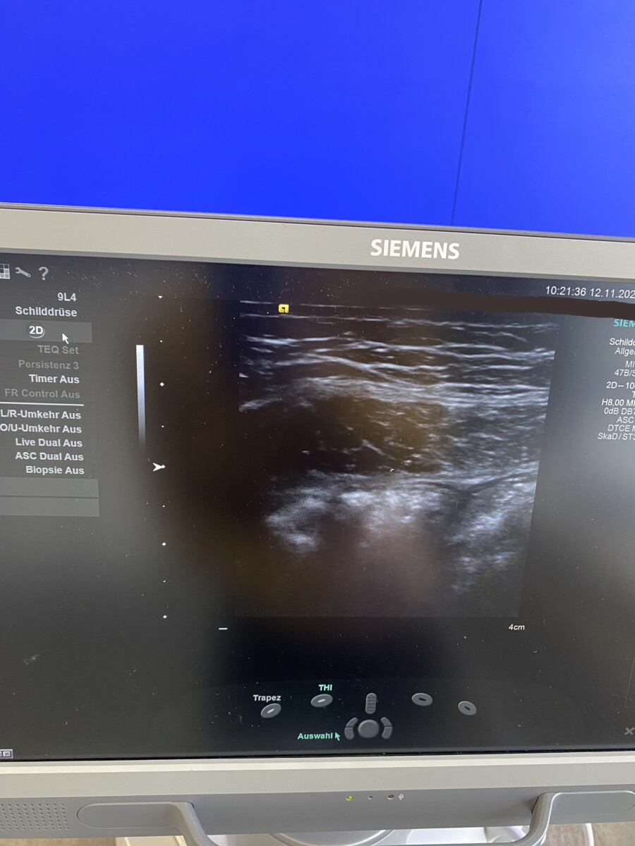 Siemens - Ultrasound System - Ultraschallgerät - ACUSON S1000 - REF 10441701