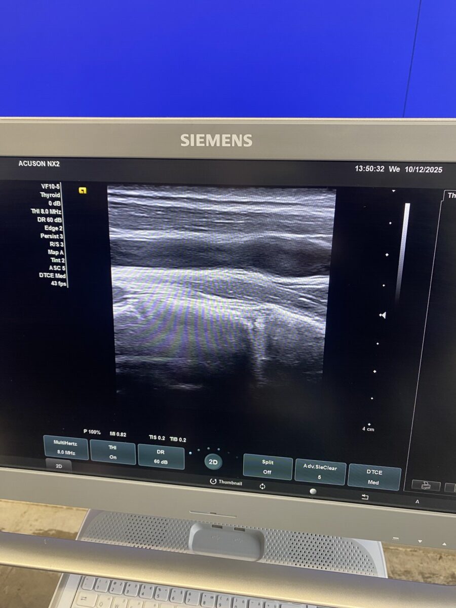 Siemens - Ultraschallsystem - Ultrasound System - ACUSON NX2 -REF 11284381