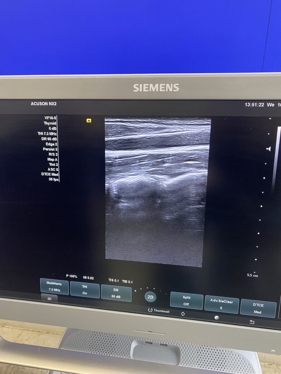 Siemens - Ultraschallsystem - Ultrasound System - ACUSON NX2 -REF 11284381