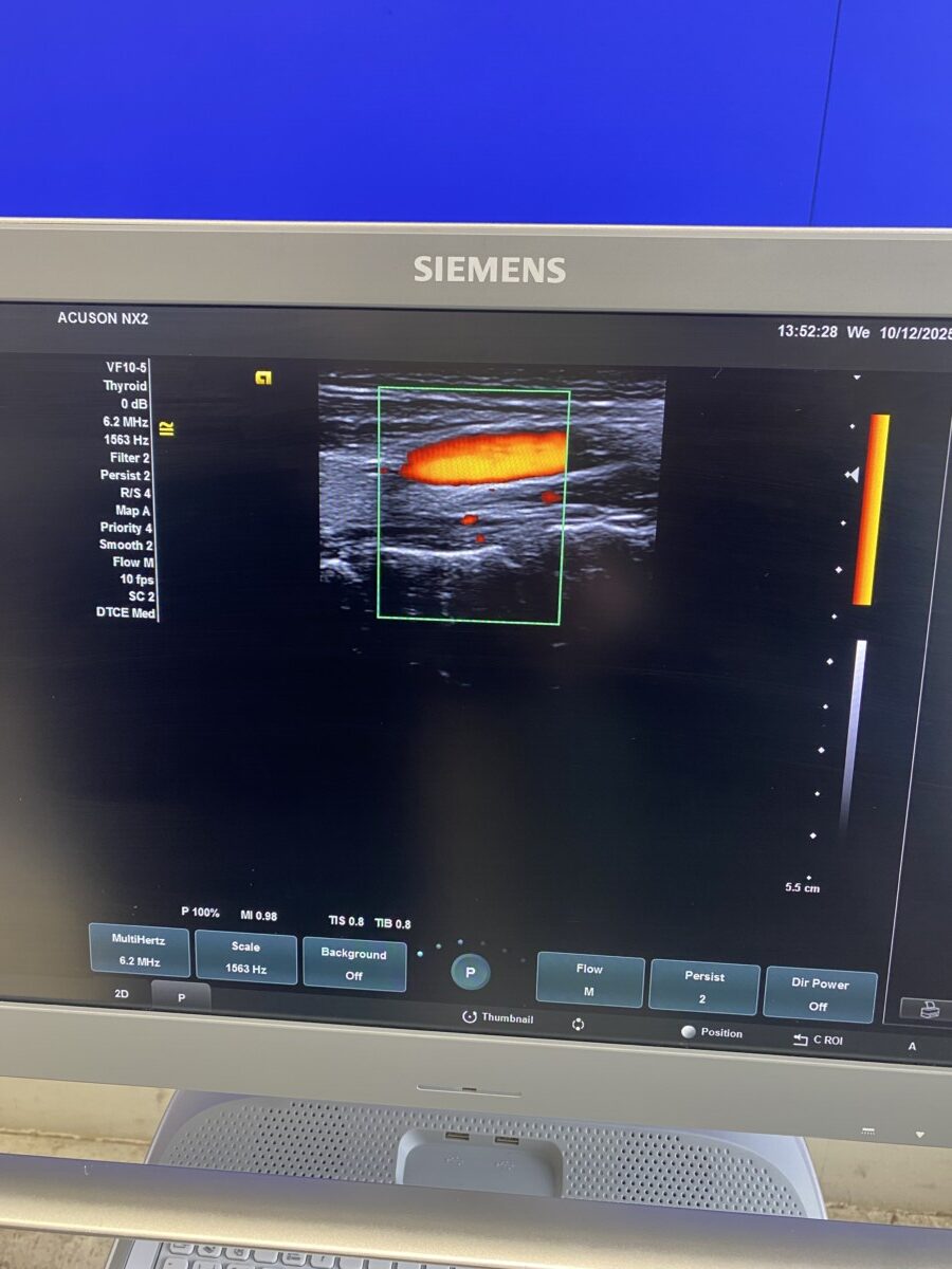 Siemens - Ultraschallsystem - Ultrasound System - ACUSON NX2 -REF 11284381