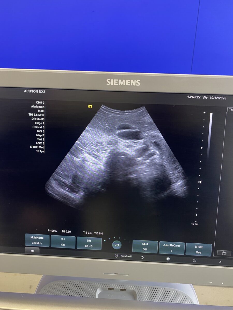 Siemens - Ultraschallsystem - Ultrasound System - ACUSON NX2 -REF 11284381