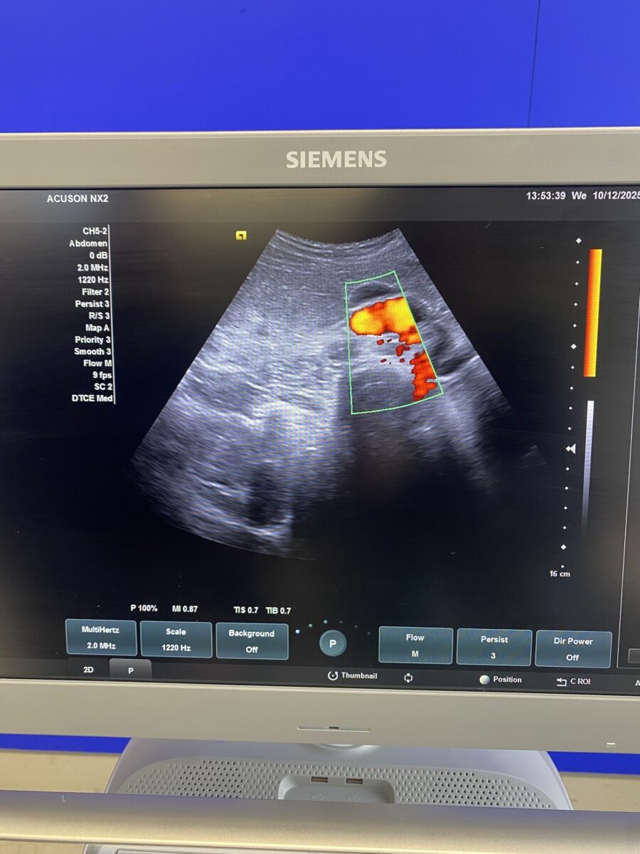 Siemens - Ultraschallsystem - Ultrasound System - ACUSON NX2 -REF 11284381