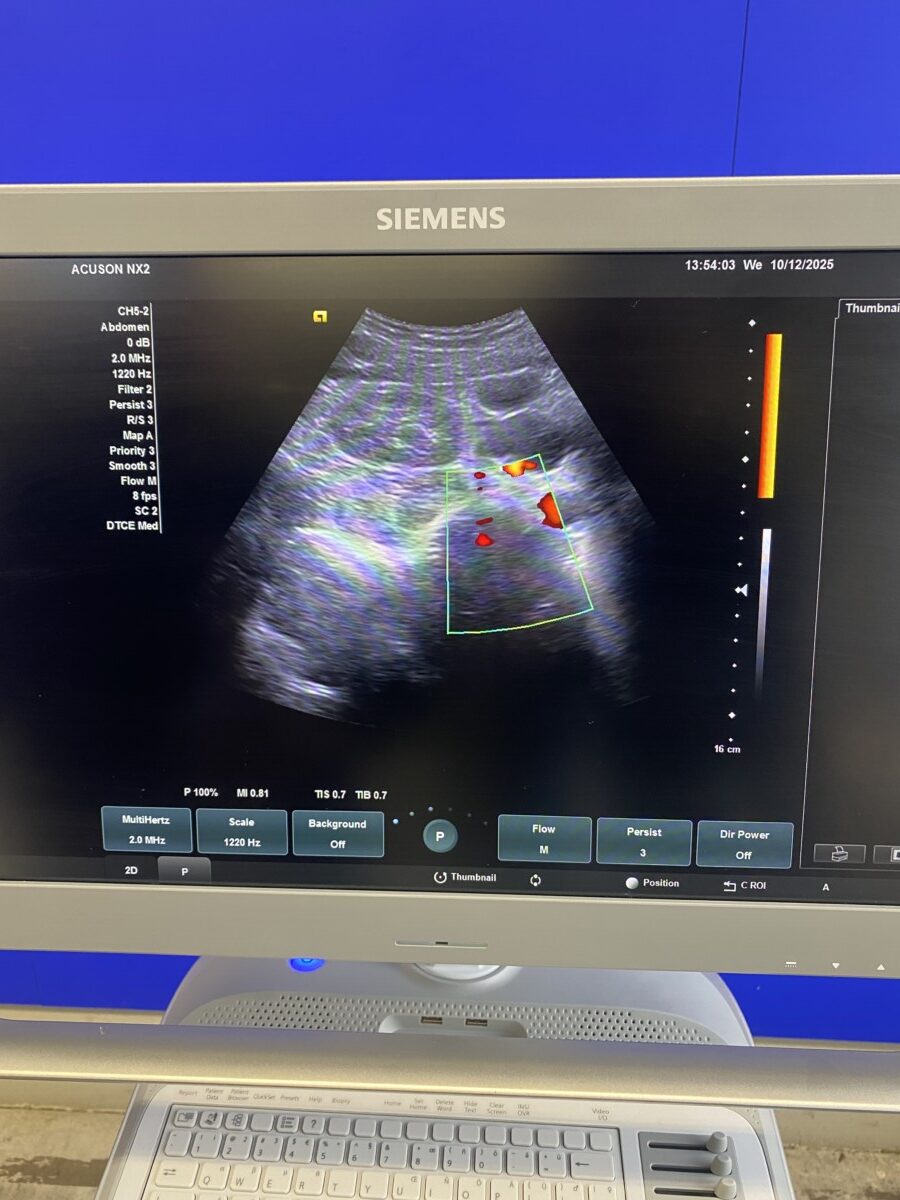 Siemens - Ultraschallsystem - Ultrasound System - ACUSON NX2 -REF 11284381