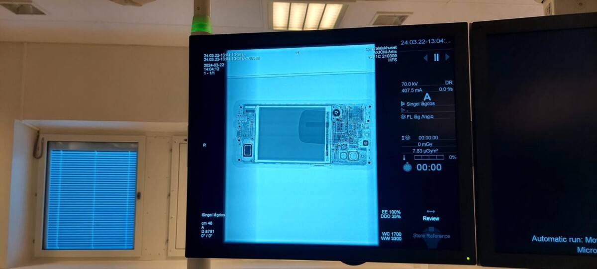Siemens - Angiography System - Angiographie-System - Artis ZeeGo