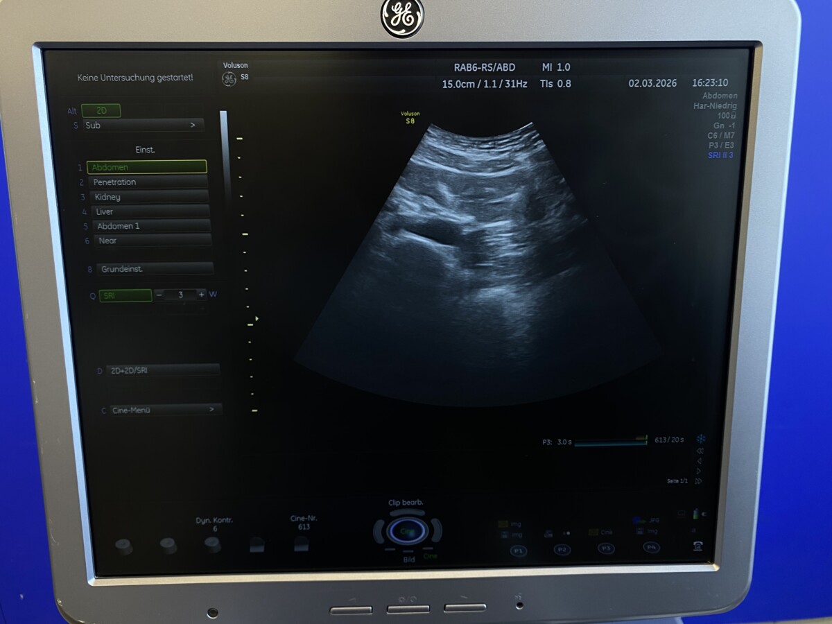 GE HealthCare - Gynäkologisches Ultraschallgerät - Gynecological Ultrasound System - Voluson S8 - REF 5483631