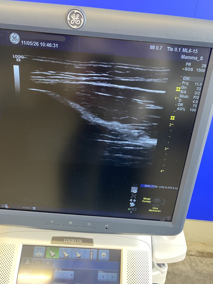 GE HealthCare - LOGIQ E9 - Ultraschallgerät - Ultrasound System - REF 5197104-2